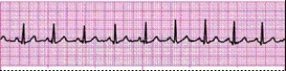 Identify the following rhythm (lead II): ____________________   