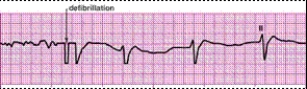 Identify the following rhythm (lead II): ____________________   