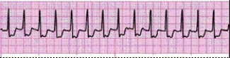 Identify the following rhythm (lead II): ____________________   