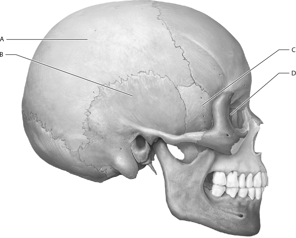 Which letter represents the sphenoid bone on this figure?   A)  A B)  B C)  C D)  D