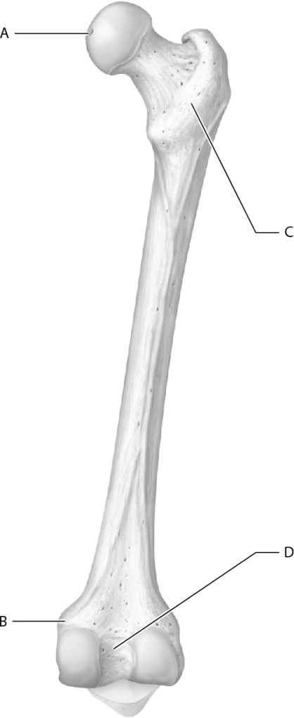 Which letter represents the intercondylar fossa on this image?   A)  A B)  B C)  C D)  D