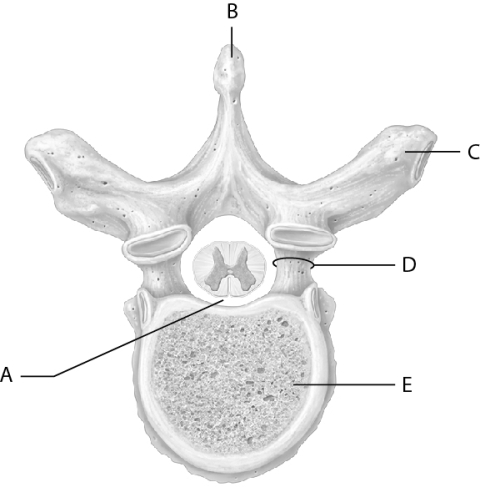 Match the following parts of the thoracic vertebra with the correct letter on the figure.    -Vertebral foramen