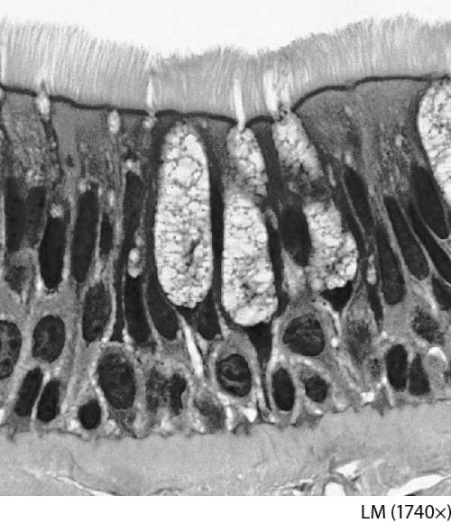 The tissue pictured in this figure is:   A)  composed of a single layer of columnar cells appearing stratified. B)  composed of two layers of columnar cells. C)  composed of multiple layers of columnar cells. D)  composed of two layers of cuboidal cells.