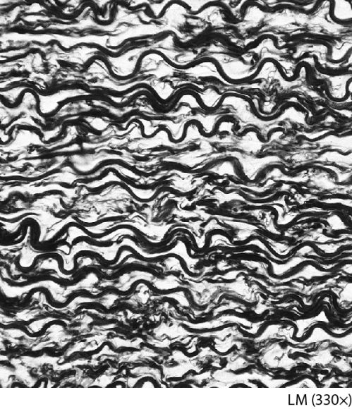 What fibers are common in this tissue?   A)  reticular only B)  collagen only C)  both elastic and some reticular D)  both elastic and some collagen