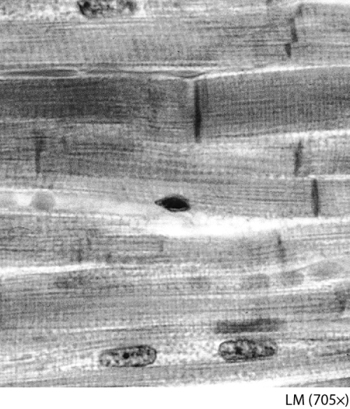 Name this tissue.   A)  cardiac muscle tissue B)  smooth muscle tissue C)  dense irregular connective tissue D)  skeletal muscle tissue