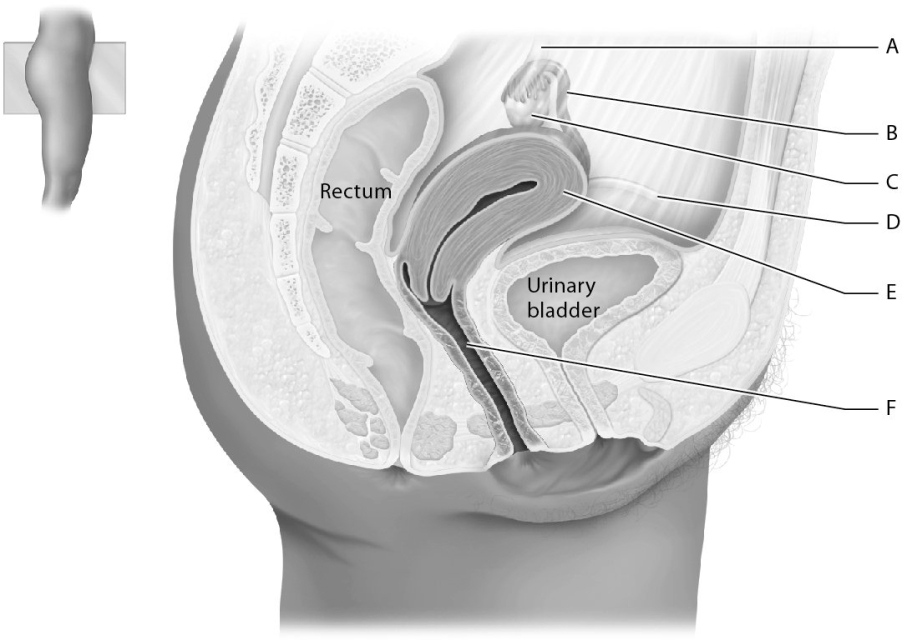 Match the following with the organs of the female reproductive system.    -Identify the round ligament.