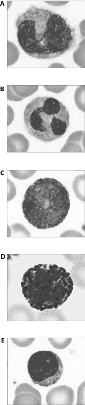 Match the following leukocytes.    -The most common type of leukocyte
