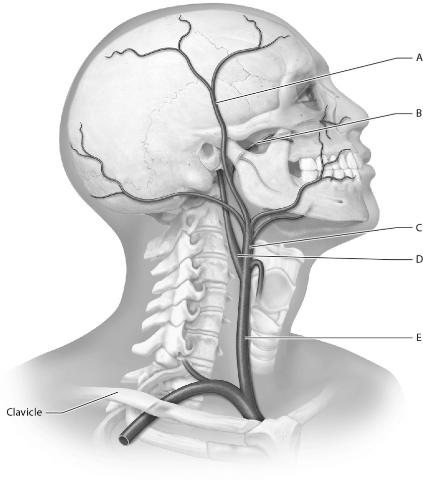 Match the following arteries with the correct name.    -Identify the maxillary artery.