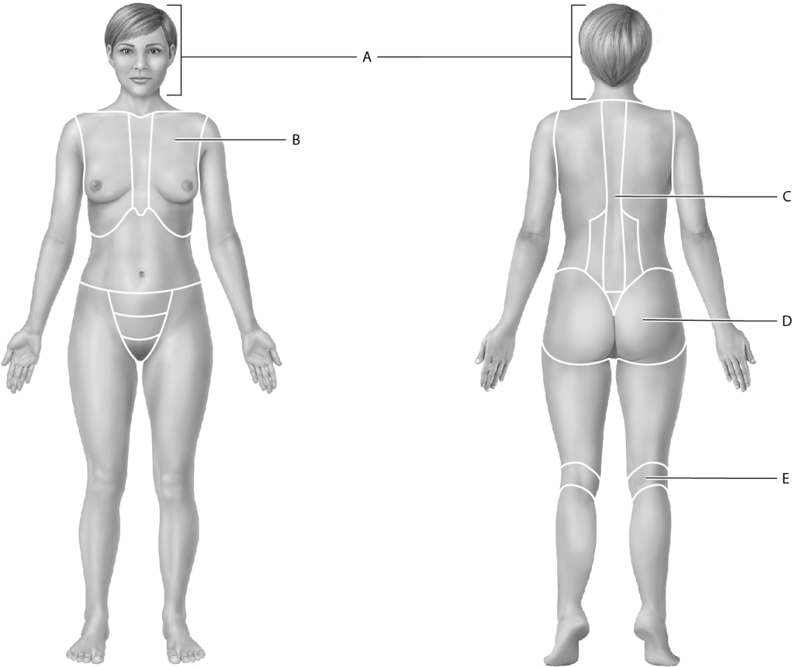 Match the following with the correct regional anatomical term.    -Identify the thoracic region.