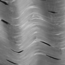 The tissue shown in the photograph forms   A)  skeletal muscle. B)  bone. C)  dense connective tissue. D)  nerves. E)  smooth muscle.