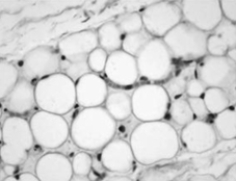 The tissue in the photograph is an example of__________ tissue.   A)  nerve B)  epithelial C)  muscle D)  connective