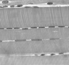 The tissue in the photograph is A) stratified epithelium. B) nerve tissue. C) skeletal muscle. D) connective tissue. E) simple epithelium.