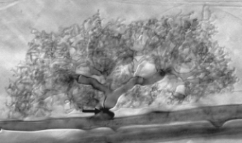 This photograph shows a glomeromycete fungus growing in the cell of a plant. The fungus will help the plant get water and minerals, and the plant will supply the fungus with some sugar. This relationship is known as   A)  a Blastoclade. B)  a lichen. C)  parasitic. D)  a mycorrhiza. E)  autotrophic.