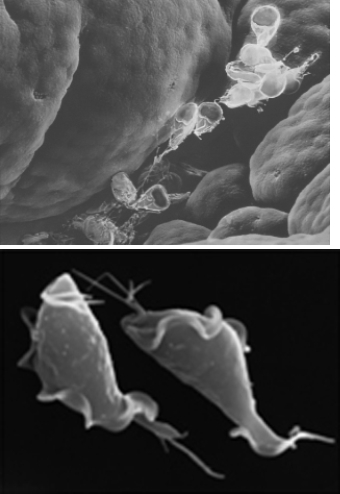 What characteristic do the organisms in the photos share?   A)  Both are photosynthetic. B)  Both have calcium carbonate shells. C)  Both use pseudopods to capture food. D)  Both are multicellular. E)  Both are parasites.