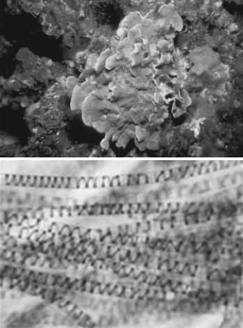 What characteristic do the organisms in the photos share?   A)  Both have calcium carbonate shells. B)  Both use pseudopods to capture food. C)  Both are parasites. D)  Both are photosynthetic. E)  Both are prokaryotic.