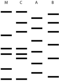   One of two men may be the father of a child. This figure shows the results of a DNA fingerprint analysis to determine paternity. M is the mother, C is the child, A and B are the two men. What is the best interpretation of these results? A)  Neither man is this childʹs father. B)  The man identified as A is probably the father. C)  The man identified as B is probably the father. D)  Either man could be this childʹs father. E)  Paternity cannot be determined from this data.