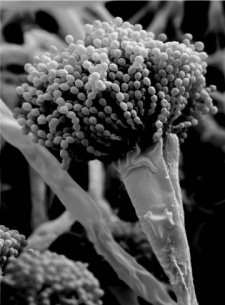   This image was most likely produced by a microscope. A)  scanning electron B)  bright-field C)  confocal D)  transmission electron E)  dark-field