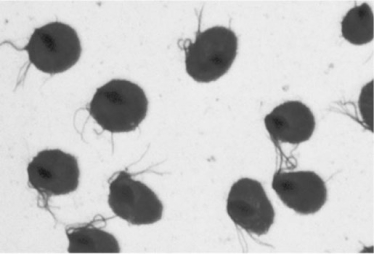   Observation of the microbes shown in the figure from a vaginal discharge specimen is diagnostic for A)  syphilis. B)  gonorrhea. C)  trachoma. D)  trichomoniasis. E)  Chlamydia infection.