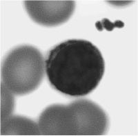   What type of white blood cell is shown in Figure 15 -1? A)  eosinophil B)  lymphocyte C)  monocyte D)  neutrophil E)  basophil