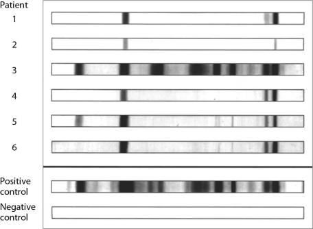   For what is the assay shown here used? A)  detecting antibodies against a complex mix of antigens B)  detecting neutralizing antibodies C)  blood typing D)  determining the concentration of antibodies E)  verifying infection with a virus