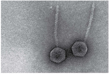   The virions shown in the figure have a (polyhedral/helical/complex) capsid.