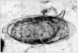   A person reports to a clinic complaining of fever and abdominal pain. The abdomen is swollen, and blood tests indicate kidney damage. A stool sample is examined under a microscope and found to contain the egg shown in the figure. The indications are consistent with infection with A)  Plasmodium falciparum. B)  Anaplasma phagocytophilium. C)  Schistosoma mansoni. D)  Toxoplasma gondii. E)  Trypanosoma cruzi.