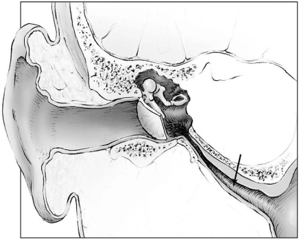   The structure indicated by the arrow connects the middle ear to what part of the respiratory system? A)  nasal cavity B)  larynx C)  pharynx D)  sinuses E)  trachea