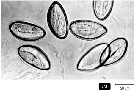   Observation of the specimens in the figure is diagnostic for A)  anisakiasis. B)  amebiasis. C)  pinworms. D)  giardiasis. E)  tapeworms.