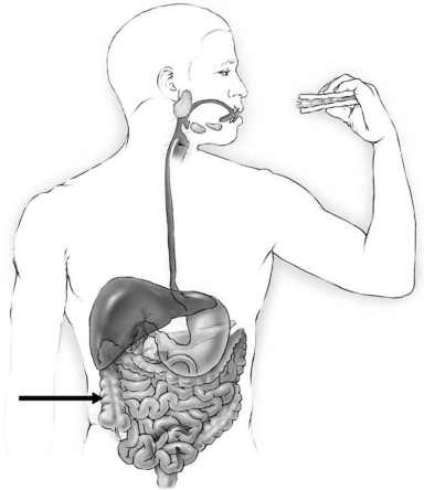    The portion of the gastrointestinal tract indicated by the arrow is the (ascending/descending/sigmoid/transverse) colon.