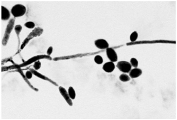   The presence of the specimen shown in the figure in a vaginal discharge is evidence of infection with A)  Candida albicans. B)  Neisseria gonorrhoeae. C)  Treponema palladium. D)  Chlamydia trachomatis. E)  Trichomonas vaginalis.