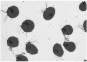   Observation of the microbes shown in the figure from a vaginal discharge specimen is diagnostic for A)  Chlamydia infection. B)  gonorrhea. C)  trichomoniasis. D)  trachoma. E)  syphilis.