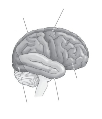 <strong> Refer to the diagram to answer the following question: A blow to the ________ of the head could lead to loss of vision.</strong> A) front B) top C) back D) side
