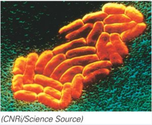<strong>This microorganism can be observed with: </strong> A)the naked eye B)a light microscope C)a scanning electron microscope D)B and C are correct
