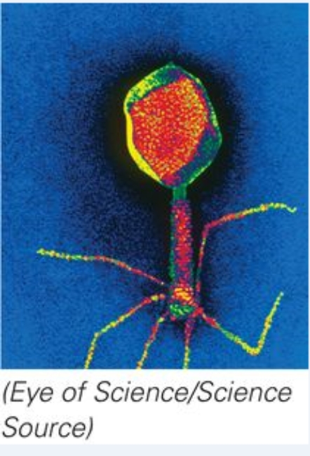 <strong>This microorganism can infect _____. </strong> A)algae B)bacteria C)viruses D)prions
