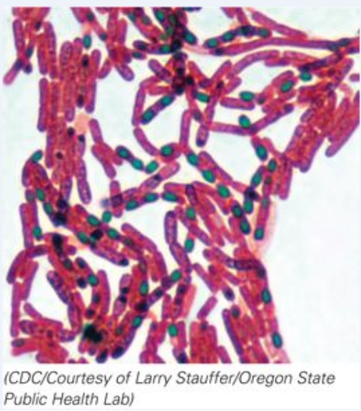 Which of the following stains has been used on this microorganism?   A) Flagellar stain B) Capsule stain C) Endospore stain D) No stain