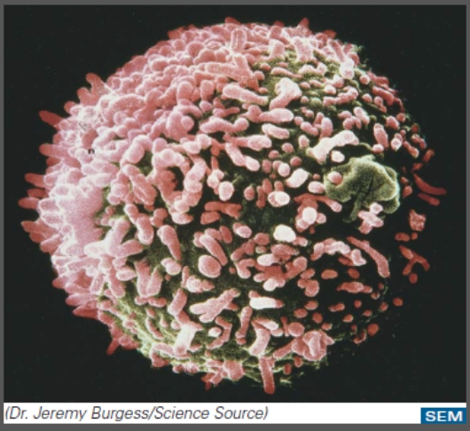 This cell is the result of fusing a:   A) cancer cell and a plasma cell. B) virus and a bacterium C) cancer cell and a virus D) plasma cell and a virus