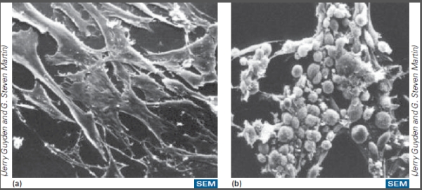 What type of effect is occurring with these cells infected by RSV?   A) Cytopathic effect B) CPE C) Nuclear effect D) Cytoplasmic effect E) Both Cytopathic effect and CPE are correct