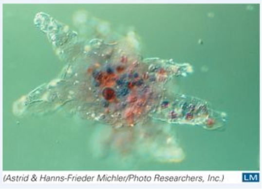 This organism moves by:   A) flagella B) cilia C) pseudopodia D) cannot move