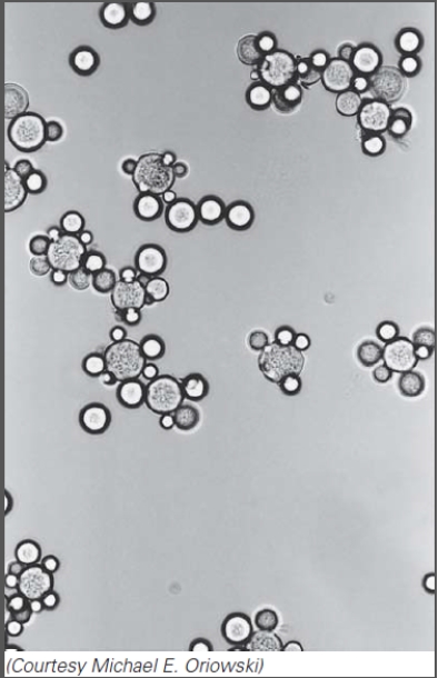 This organism belongs to the:   A) protists B) arthropods C) helminths D) fungi