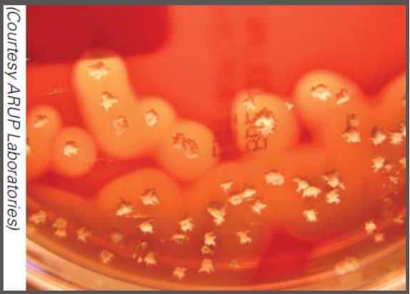 What type of toxin is illustrated in this image?   A) Endotoxin B) Exotoxin C) Enterotoxin D) Neurotoxin