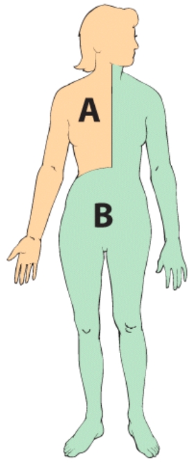 Region  A  in this image drains lymph into the:   A) right carotid artery B) right subclavian vein C) superior vena cava D) inferior vena cava