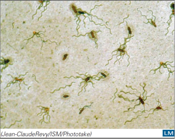 This organism is the cause of _____. A) shigellosis B) staphylococcal food poisoning C) dental caries D) typhoid fever