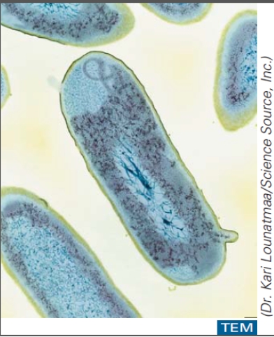 This organism is a/an: A) fungus B) protozoan C) virus D) bacterium E) worm