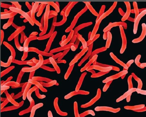 This organism can survive in:   A) warm, acidic water if urine is present B) cool, acidic water if blood is present C) neutral water D) cool, alkaline water if organic matter is present