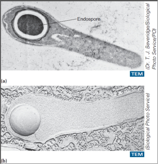 This organism can exist in the spore form and cause tetanus.   A) Mycobacterium leprae B) Clostridium tetani C) Clostridium difficile D) Clostridium botulinum