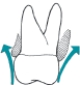 <strong>Which illustration in depicts an overcontoured restoration?</strong> A) B) C)
