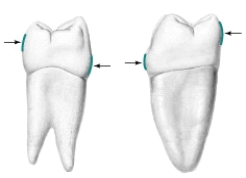 <strong>What are the arrows pointing to in the illustration below? </strong> A) Contact areas B) Height of curvature C) Buccal contour D) Excess curvature E) None of the above
