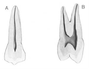Figure  A  below is which tooth?   A)  Maxillary right second premolar B)  Maxillary left second premolar C)  Maxillary right first premolar D)  Maxillary left first premolar