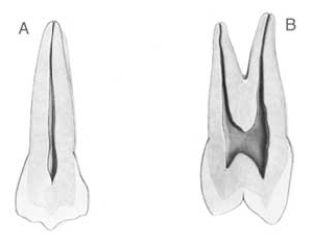 Figure  B  below illustrates a view of which surface?   A)  Buccal B)  Lingual C)  Mesial D)  Distal