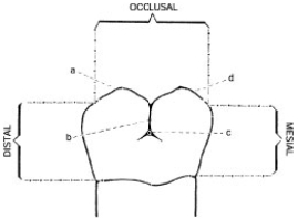 <strong>Below is an illustration of the buccal surface of a mandibular right second molar. Structure d depicts the </strong> A) Distobuccal cusp B) Mesiobuccal cusp C) Buccal groove D) Buccal pit